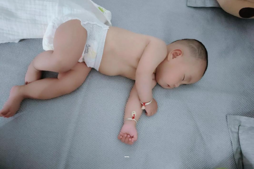 河源宝宝脸上有白色斑块